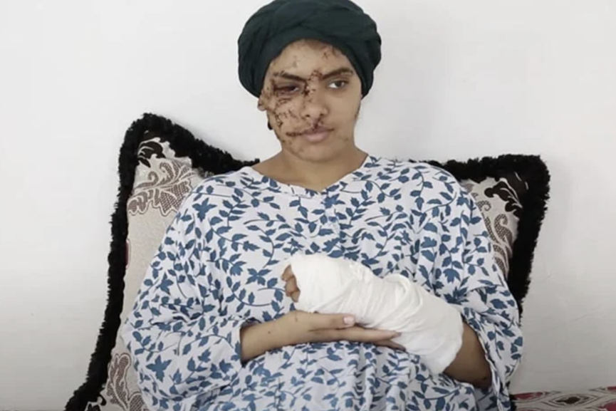 "قضية إيمان".. ضحية للعنف الأسري تكشف مأساة “التشرميل” ضد النساء