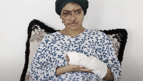 "قضية إيمان".. ضحية للعنف الأسري تكشف مأساة “التشرميل” ضد النساء