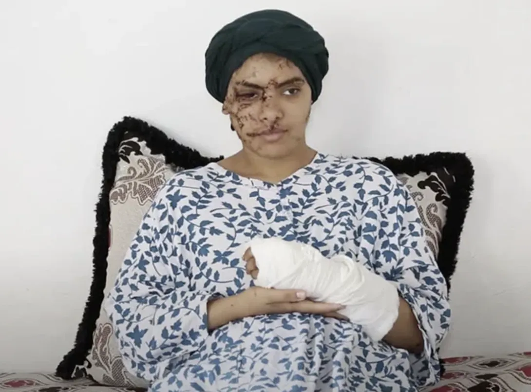 "قضية إيمان".. ضحية للعنف الأسري تكشف مأساة “التشرميل” ضد النساء