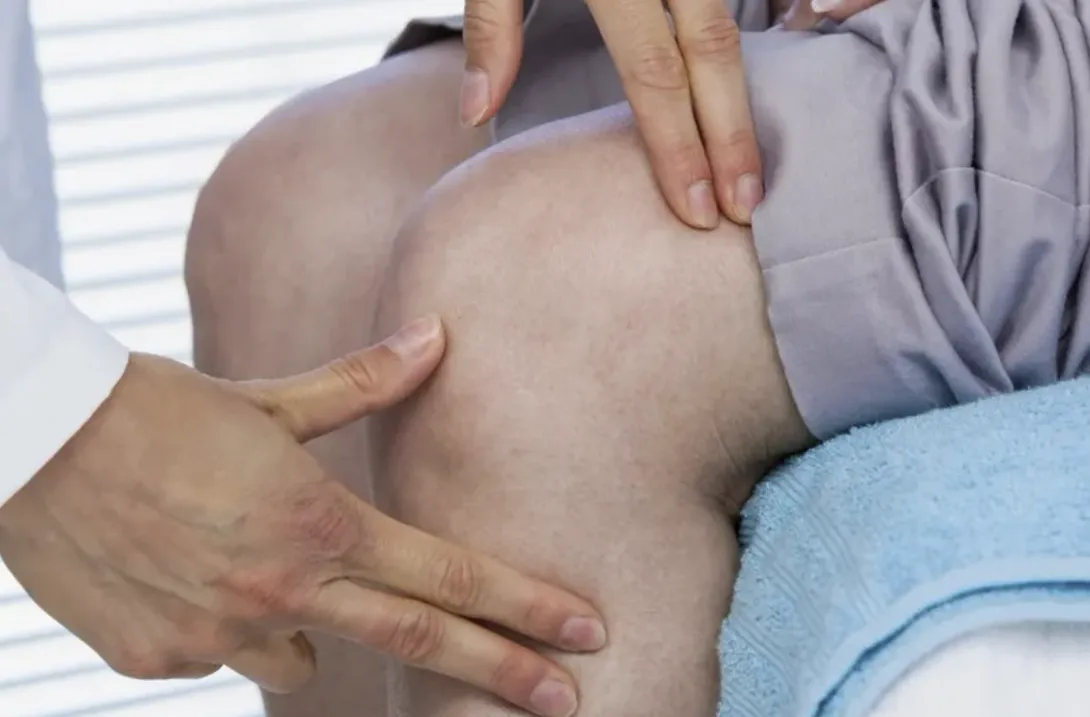 دراسة ألمانية: التمارين الرياضية تُحسّن جودة الحياة اليومية وتخفف آلام مفصل الركبة 